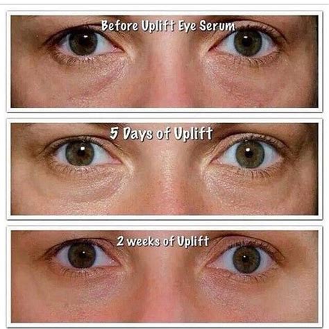 Before And After Of What Our Uplift Eye Serum Really Does Shop Here