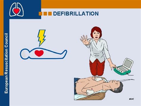 European Resuscitation Council ADULT BASIC LIFE SUPPORT BLS