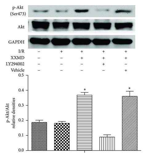 Western Blot Analysis Of Phosphorylation Levels Of Akt Gsk And