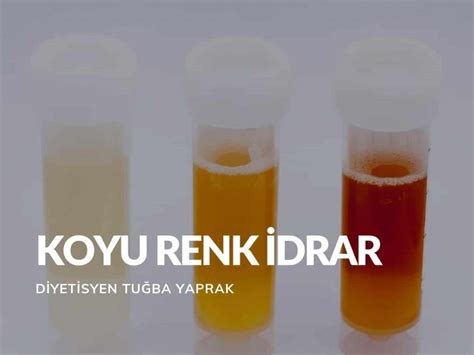 İdrar Renklerinin Anlamları Ve Koyu Renk İdrar Diyetisyen Tuğba Yaprak