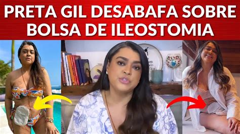 Preta Gil Desabafa E Explica Uso Da Bolsa Da Ileostomia Youtube