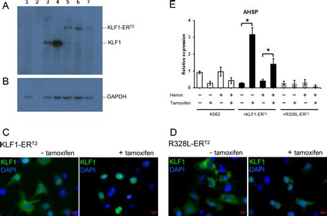 Activation Of KLF1 Enhances The Differentiation And Maturation Of Red