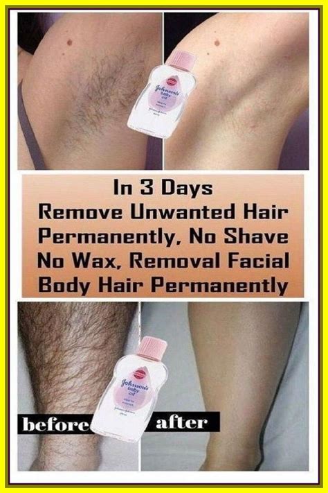 Remove Unwanted Hair Permanently Artofit