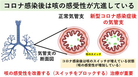 新型コロナウイルス感染後に出る咳｜名古屋おもて内科・呼吸器内科クリニック｜荒畑駅・御器所駅