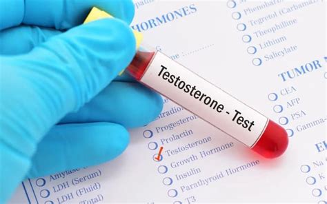 O Que Saber Sobre O Teste De Testosterona Tookmed