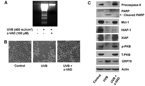 Uvb Induced Anti Survival And Pro Apoptotic Effects On Hacat Human