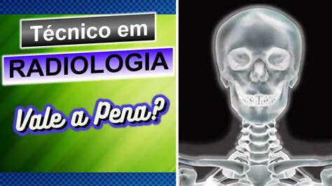 Quanto ganha um radiologista Escola Educação