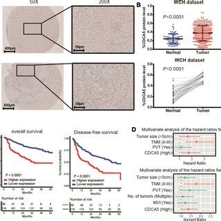 CDCA5 Is Upregulated In HCC Tissues And Predicts Poorer Survival