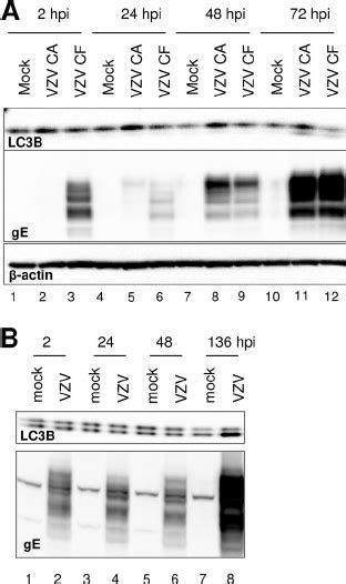 Autophagy Is Induced In MRC 5 Or MeWo Cells Infected With Cell Free