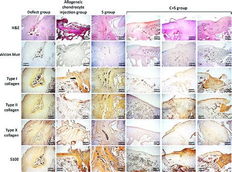 Histological Evaluation Of Regenerated Cartilage At 2 Months Post Op Download Scientific