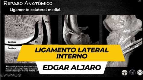 Ligamento Lateral Interno Ecograf A Y Anatom A Muptherapy Youtube