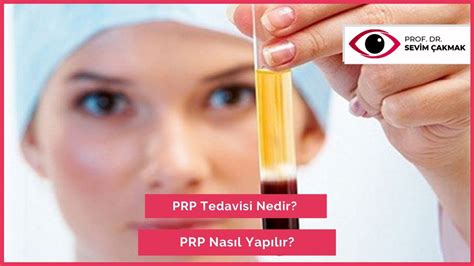 PRP Tedavisi Nedir PRP Nasıl Yapılır PRP Platelet Rich Plasma