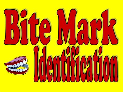 Bite Mark Identification Ppt Download