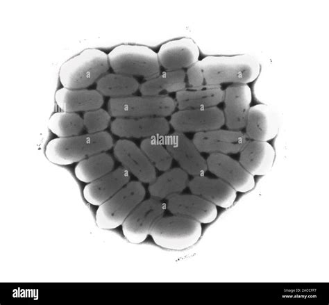 E Coli Enterohaemorrhagic Bacteria Transmission Electron Micrograph