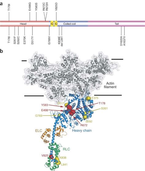 Mutations In Embryonic Myosin Heavy Chain MYH3 Cause Freeman