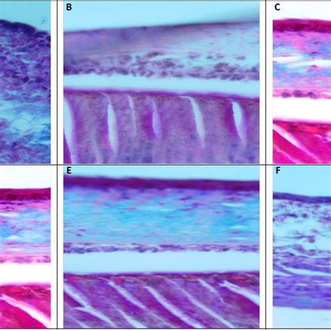 Massons Trichrome Staining Histopathology 400x Of The Infected Eye Download Scientific