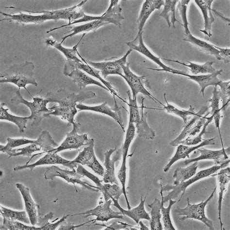 Human Schwann Cells - Innoprot Spinal Nerve Cell System