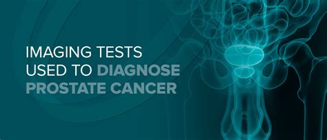 Imaging Tests Used To Diagnose Prostate Cancer Envision Radiology