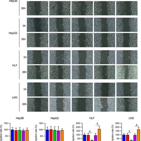 Migration Of Hepatocellular Carcinoma Hcc Cell Lines With