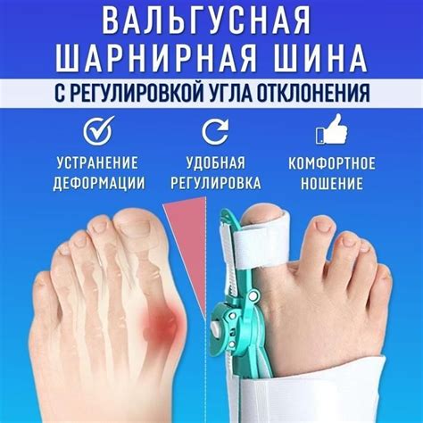 Ортез На Большой Палец Стопы – купить в интернет-аптеке OZON по низкой цене