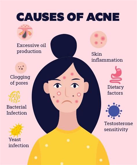 Alinak Acne Causes Acne Yeast Infection