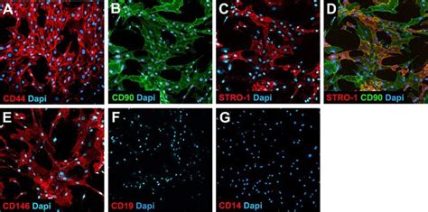 Mesenchymal Stem Cell Culture