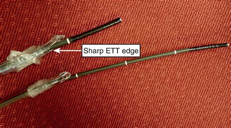 Flexible Scope Intubation Techniques Clinical Tree