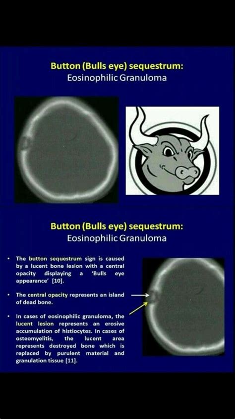 Chest Undergraduate Diagnostic Imaging Fundamentals Artofit