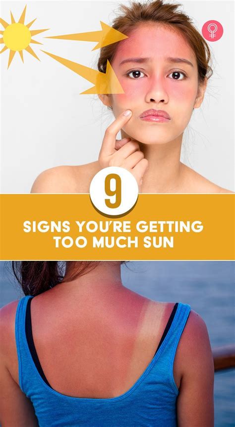 9 Signs Youre Getting Too Much Sun Red Dry Skin Skin Care Tips Bumpy Skin