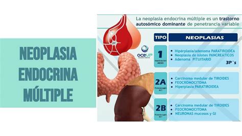 Neoplasia Endocrina Múltiple Ariana Ahumada uDocz