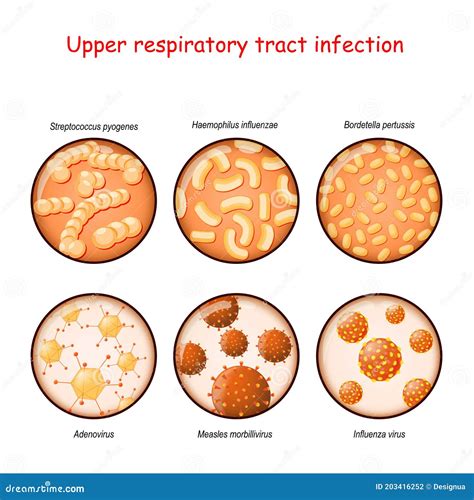 Respiratory Infection. Bacteria and Viruses Stock Vector - Illustration of bacillus ...