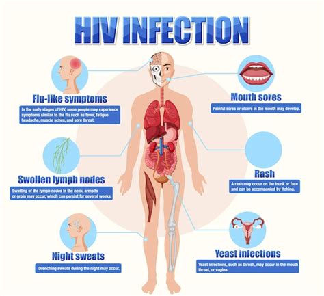 Informatives Poster Zur Hiv Infektion Kostenlose Vektor