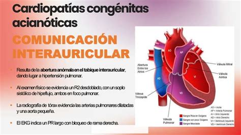 Cardiopatia Congenitas Clasificacion Presentacion Clinicas Y