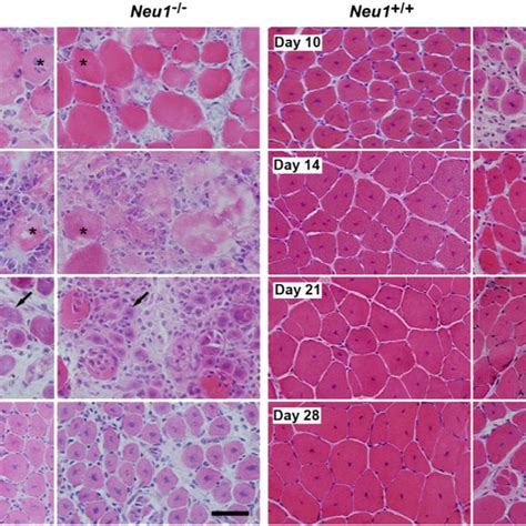 Immunohistochemical Staining For Collagen III In Neu1 And Neu1