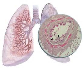 Bronchiolitis Obliterans Bo