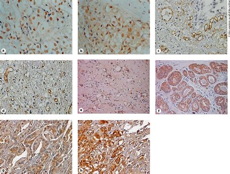 Figure From The Angiogenic Switch For Vascular Endothelial Growth