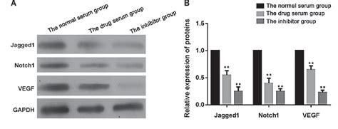 Figure 5 From The Role Of Jagged1 Notch Pathway Mediated Angiogenesis Of Hepatocarcinoma Cells