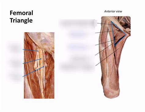 Mss Femoral Triangle Diagram Quizlet