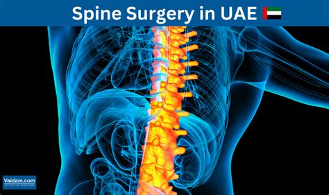 Spine Surgery In Uae Vaidam Health