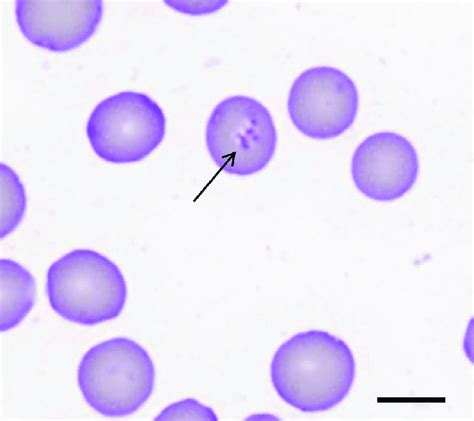 Photomicrograph Of Diff Quik Stained Blood Smear From Black Rhinoceros