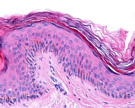 Melanocytes Histology