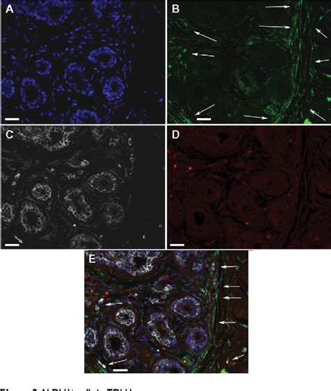 Figure 2 From The Absence Of Aldehyde Dehydrogenase 1 A1 Positive Cells