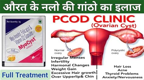 myo inositol folic acid with vitamin d3 powder PCOD Cyst औरत क