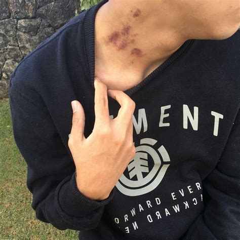 Cɧɷcųɭateɩ Hickies Relationship Goals Hickies Neck Aesthetic Guy