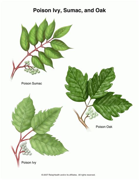 Poison Ivy Oak Sumac Causes Symptoms Treatment Poison Ivy Oak Sumac