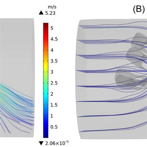 The Instantaneous Streamlines Of Transmitral Flow Colored By The