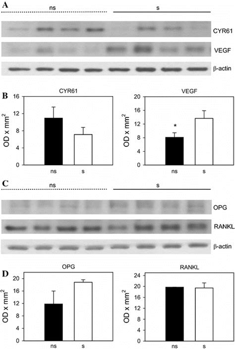 Western Blot Analysis Of The Expression Of Cyr61 And Vegf A B And