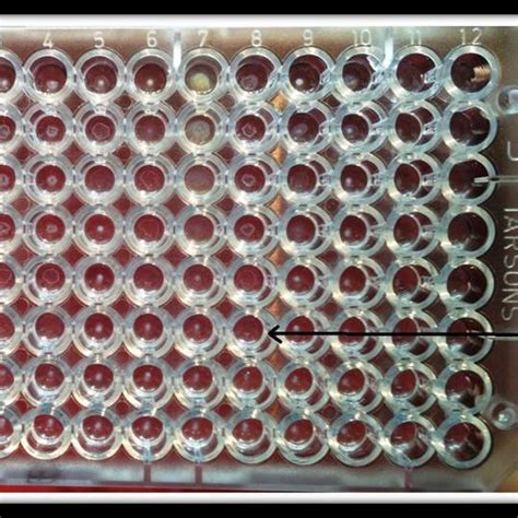 Standard Tube Agglutination Test Stat Note The Mat Formation Upto Download Scientific