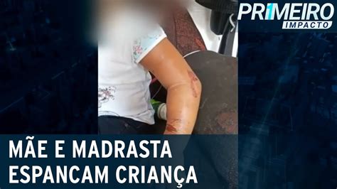 Mãe e madrasta são presas suspeitas de espancar criança de 4 anos