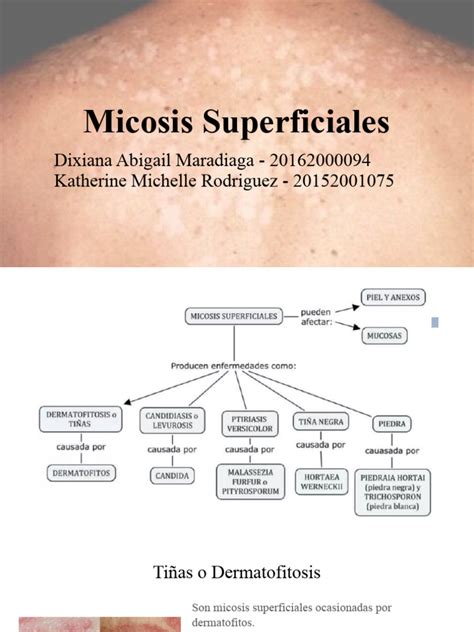 Micosis Superficiales Descargar Gratis Pdf Especialidades Medicas Microbiología